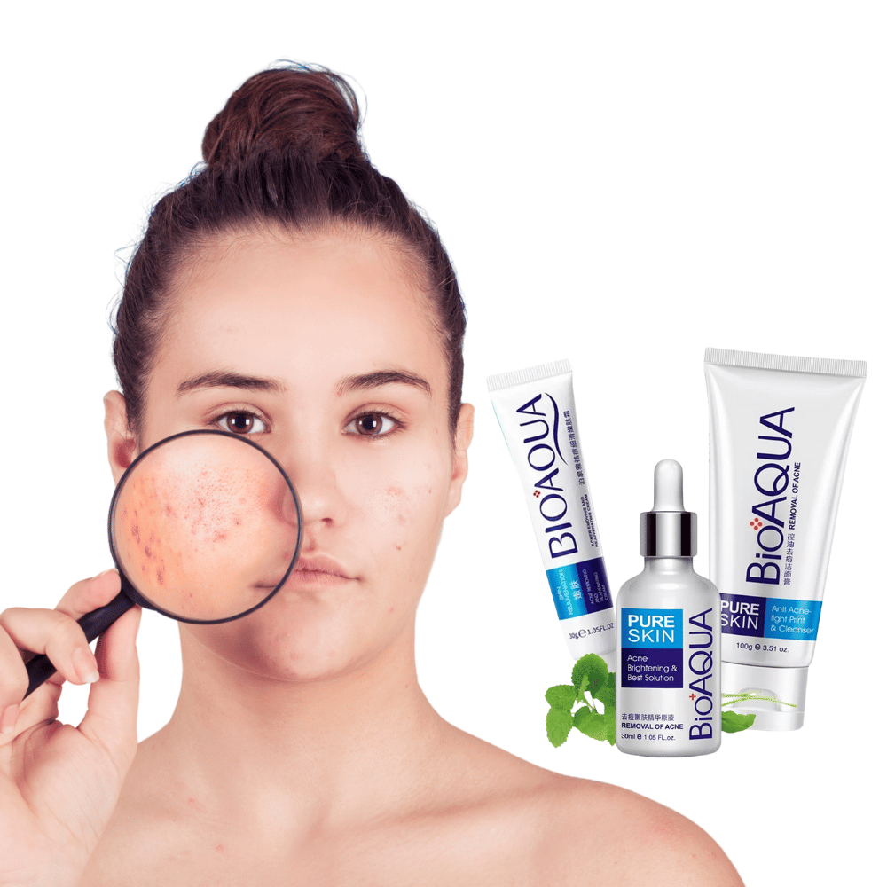 Kit Acné Pure Skin X4 Productos