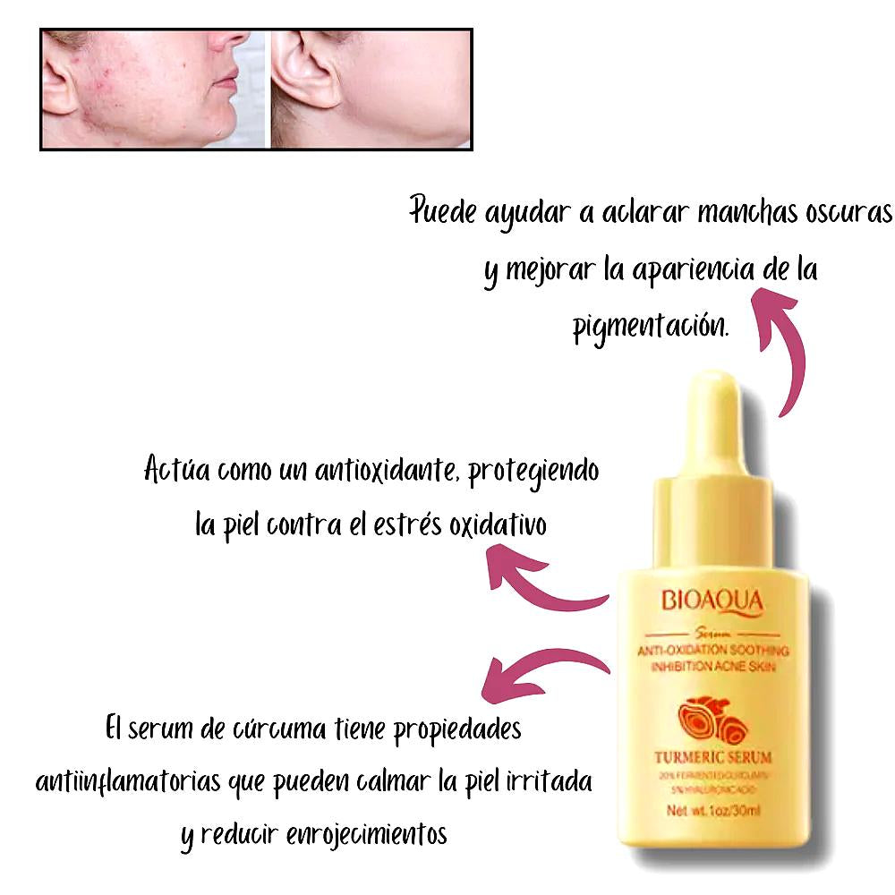 Serum Anti Acné De Curcuma Bioaqua