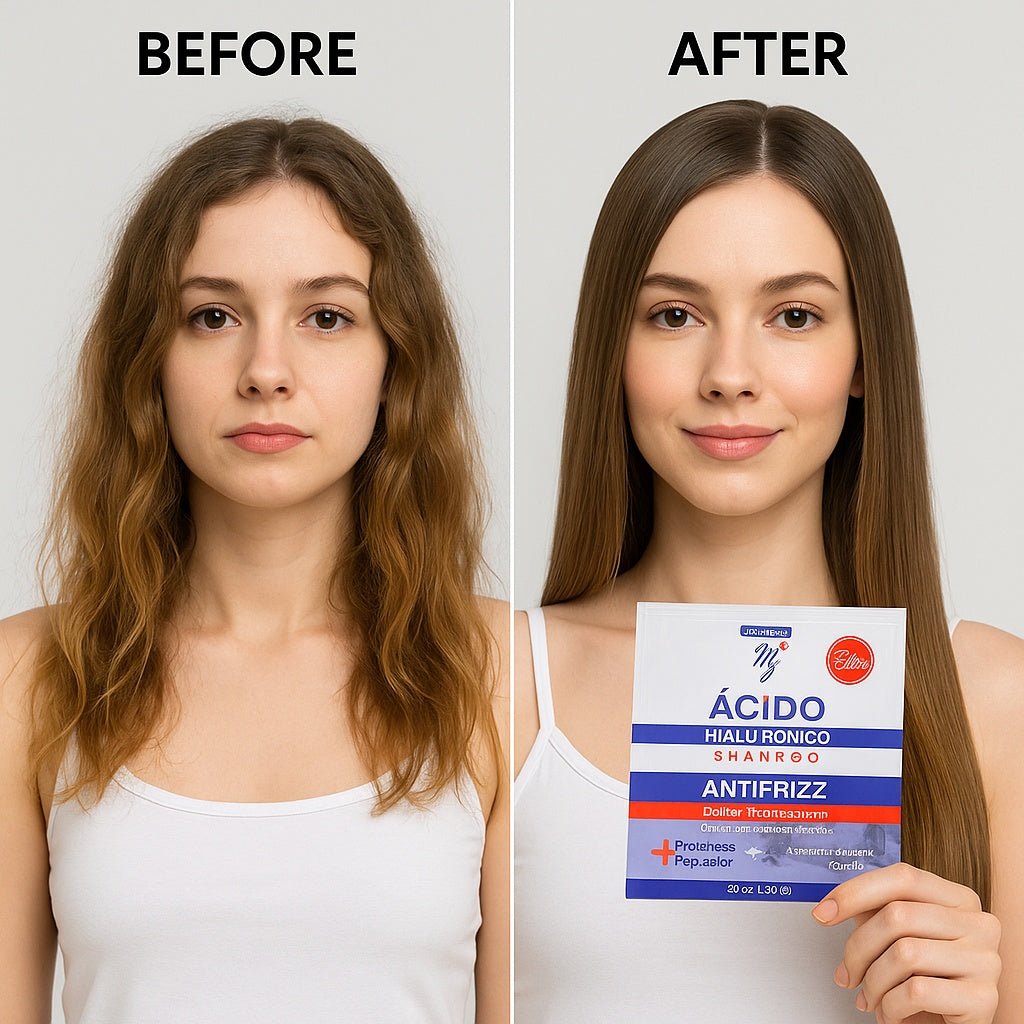 Shampoo Acido y Aluronico  Antifriz M y E